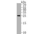 RAB27B Antibody in Western Blot (WB)