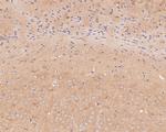 TTL Polyclonal Antibody