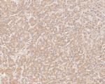 GBP2 Polyclonal Antibody