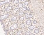 GBP2 Antibody in Immunohistochemistry (Paraffin) (IHC (P))