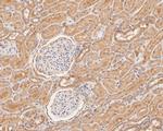 GBP2 Antibody in Immunohistochemistry (Paraffin) (IHC (P))