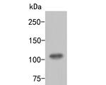ARF16 Antibody in Western Blot (WB)