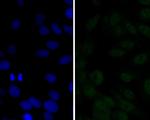 p16INK4a Polyclonal Antibody