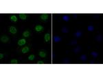 CLIC1 Polyclonal Antibody