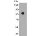 Smoothelin Antibody in Western Blot (WB)