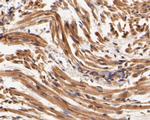 SYNDIG1 Polyclonal Antibody