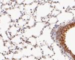 ILF1 Antibody in Immunohistochemistry (Paraffin) (IHC (P))