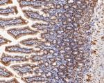 ILF1 Antibody in Immunohistochemistry (Paraffin) (IHC (P))