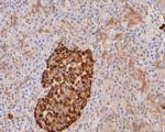 Apolipoprotein J Polyclonal Antibody