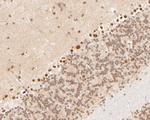 Cullin 4B Polyclonal Antibody