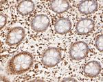 Cullin 4B Antibody in Immunohistochemistry (Paraffin) (IHC (P))