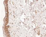 TMX4 Antibody in Immunohistochemistry (Paraffin) (IHC (P))
