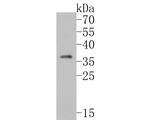 TMX4 Antibody in Western Blot (WB)