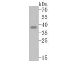 TMX4 Antibody in Western Blot (WB)