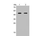 RAD51B Polyclonal Antibody