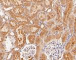 HPD Antibody in Immunohistochemistry (Paraffin) (IHC (P))