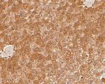 HPD Polyclonal Antibody