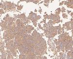 PDCD6 Polyclonal Antibody