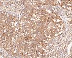 NAT1 Polyclonal Antibody