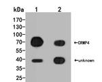 DPYSL3 Polyclonal Antibody
