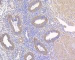 NLK Antibody in Immunohistochemistry (Paraffin) (IHC (P))
