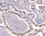 NLK Antibody in Immunohistochemistry (Paraffin) (IHC (P))