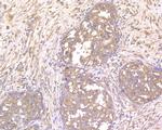 NLK Antibody in Immunohistochemistry (Paraffin) (IHC (P))