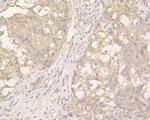 PKP3 Antibody in Immunohistochemistry (Paraffin) (IHC (P))