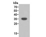 SULT1E1 Antibody in Western Blot (WB)