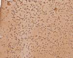 PHLDA1 Antibody in Immunohistochemistry (Paraffin) (IHC (P))