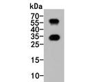 CD69 Antibody in Western Blot (WB)