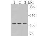 NMDAR3B Polyclonal Antibody