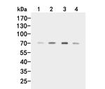 ACVR2A Polyclonal Antibody
