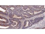 ADSL Polyclonal Antibody