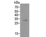 SCN1A Polyclonal Antibody