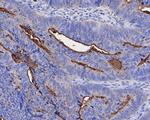 CEACAM8 Polyclonal Antibody