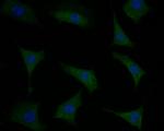 Phospholamban Polyclonal Antibody