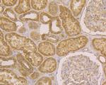 JNK2 Antibody in Immunohistochemistry (Paraffin) (IHC (P))