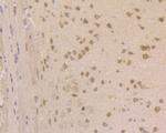 JNK2 Antibody in Immunohistochemistry (Paraffin) (IHC (P))