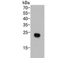 AP repeat Antibody in Western Blot (WB)