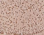 TCF21 Polyclonal Antibody