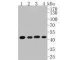 SCD Polyclonal Antibody