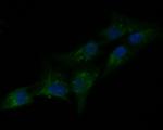 PAI1 Polyclonal Antibody