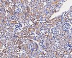 PAI1 Antibody in Immunohistochemistry (Paraffin) (IHC (P))