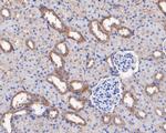 GNB3 Antibody in Immunohistochemistry (Paraffin) (IHC (P))
