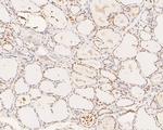 XPA Antibody in Immunohistochemistry (Paraffin) (IHC (P))