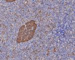 GNAO1 Polyclonal Antibody