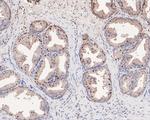 PP1 gamma Polyclonal Antibody