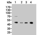 PIP4K2C Polyclonal Antibody