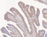 TNFR1 Polyclonal Antibody